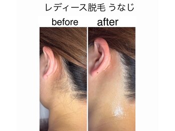 アオドットアール(Ao.r)/一度でこんなに変わる!