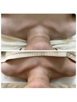 ルルボーテ(Loulou Beaute)/VOS/グレーズソフトピール