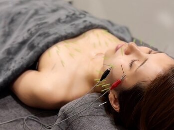 ハリスタ(HARISTA)の写真/完全個室のプライベートサロン◇痛みの少ない鍼でお悩みにしっかりとアプローチ！美しいバストラインに♪
