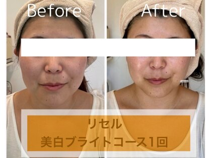 リージュ(Riju)の写真