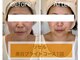 リージュ(Riju)の写真