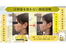 ティー(T)の雰囲気（SNSで人気殺到！レモンボトルでお顔のリフトアップ・小顔実現！）