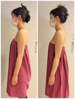 ロココ 豊田店(Rococo)/ビフォーアフター