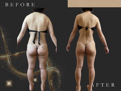 フィカス(FICUS)の写真