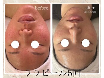 サロン ド ボーテ ラーンジュ 岐阜店(salon de beaut'e L'ange)/ララピール＆ＬＤＭ