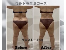 フルーア(FULUA)/ウルトランスフォーマー全身