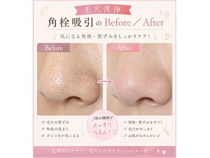 ビューティーフェイス トナリエ宇都宮店の写真
