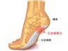 【踵の痛み】足底筋膜の痛み☆歪みから着目した根本改善施術￥5,600→￥3,980