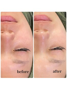 ラシック(Rachic)/クリスタルハーブパック☆