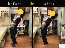 杉本接骨鍼灸院/若々しい背骨を取り戻す整体