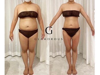 サロン ギフト(Gift)/ダイエット無料カウンセリング