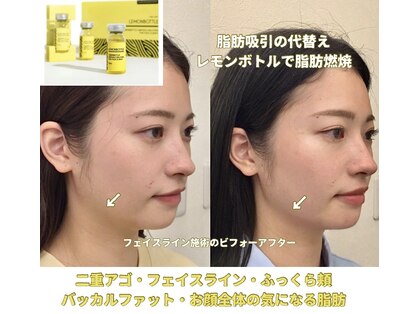 美助(bisuke)の写真