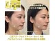 美助(bisuke)の写真
