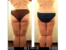 バービーホリック(barbie holic)/１６０コース　初回と５回目比較