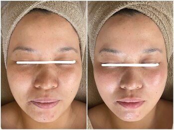 メイン(main)/★before after★