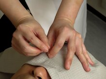 鍼灸ねこの手 高輪の雰囲気（眼精疲労に接触鍼をしているところです。しつこい目の疲れに）