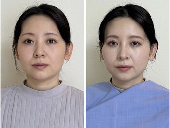 シキサイ 千葉船橋(SIKI-SAI)/トータル診断＋メイクレッスン