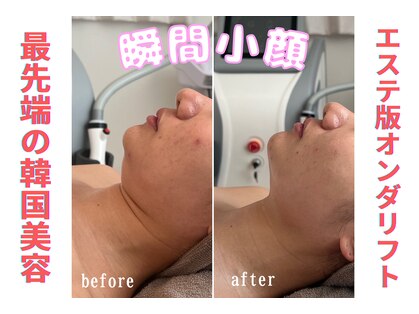 リリー(LILY)の写真