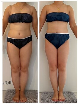 エムプリュ 心斎橋店(M.plus)/美脚コース2回目！