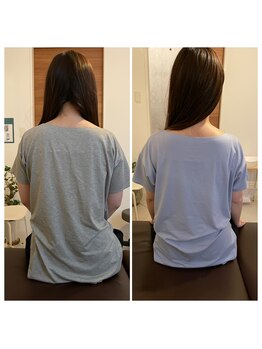 ハルノハナ鍼灸治療院/後ろ姿が綺麗♪