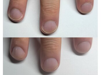 阿良波々岐(アラハバキ)/本気で爪育成したい方へ