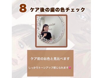 ホワイトニングショップ 吉祥寺店/施術の流れ