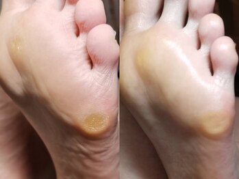 ラウン Nail salon Roun/ドイツ式フットケア