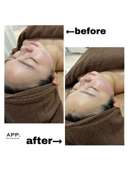 アプ(APP.)/最新美顔器&小顔マッサージで◎