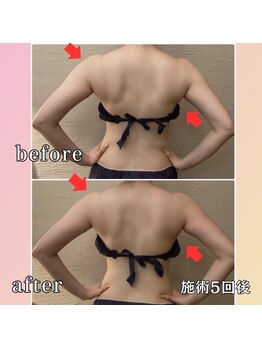 プリマジュール/【ブライダルの方必見】集中痩身