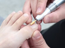 あゆむ鍼灸接骨院/★施術風景★肥厚爪.爪ケア