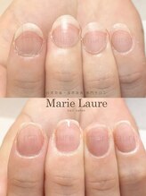マリーロール 淀屋橋本店(Marie Laure)/自爪育成/深爪矯正/ネイルケア