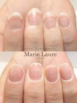 マリーロール 淀屋橋本店(Marie Laure)/自爪育成/深爪矯正/ネイルケア