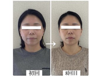 ラボーテヴェリテ(La Beaute Verite)/【お客様施術例】