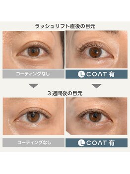 リッカ ドゥ ボーテ(RICCA de beaute)/特許技術Lコート【LED】