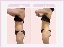 スリムライン 八戸店(The Slim Line)/before→after