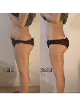 シーアイエステティック 船橋駅前店(c.iエステティック)/ブライダル痩身