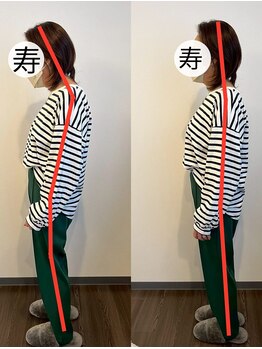 整体寿 八王子院(KOTOBUKI)/劇的ビフォーアフター！