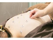 代官山アサ接骨院 鍼灸院(代官山 Asa 接骨院 鍼灸院)/冷え性などの体のケアに◎