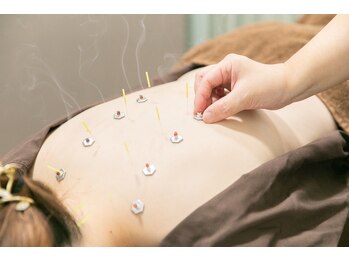 代官山アサ接骨院 鍼灸院(代官山 Asa 接骨院 鍼灸院)/冷え性などの体のケアに◎