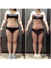 フローボディ 新山口店(flow BODY)/山口のエステはflow BODY