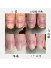 イズム(Izm)/55深爪育成/