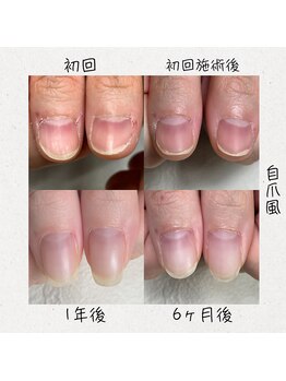イズム(Izm)/55深爪育成/