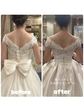 美容矯正専門サロン アカデミア(ACADEMIA)/花嫁様before after #ブライダル