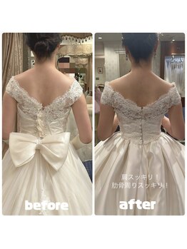 美容矯正専門サロン アカデミア(ACADEMIA)/花嫁様before after #ブライダル
