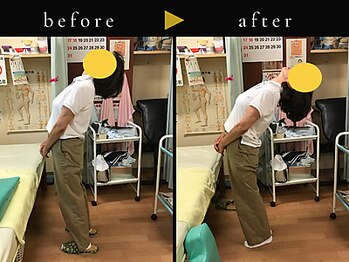 杉本接骨鍼灸院/若々しい背骨を取り戻す整体