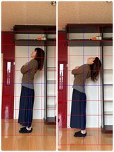 カケル鍼灸整体院(KAKERU鍼灸整体院)/腰痛改善 