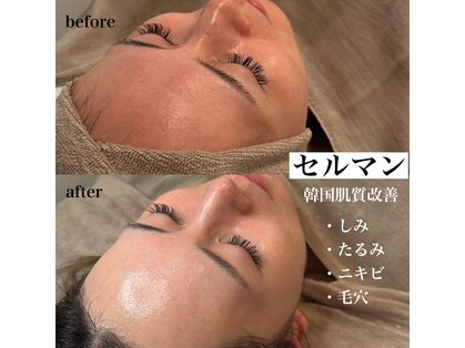 ロミエール(LOMIERE)の写真