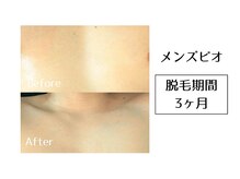 メンズビオ 神戸三宮店/