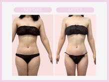 スリムライン 八戸店(The Slim Line)/before→after