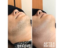 リズム(LISM)の雰囲気（3回お試しで効果を実感！）